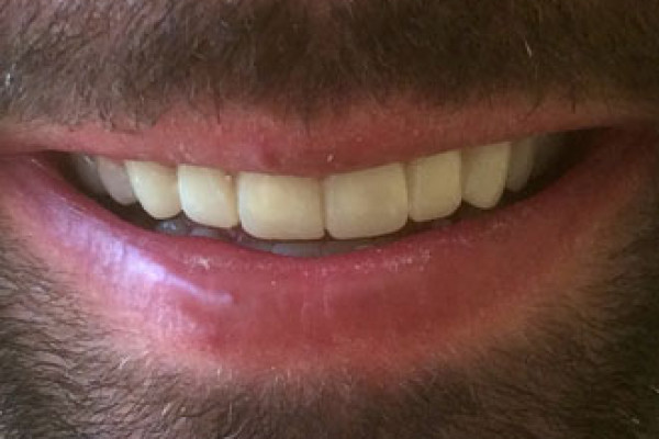 Battle Ground Cosmetic Dentist