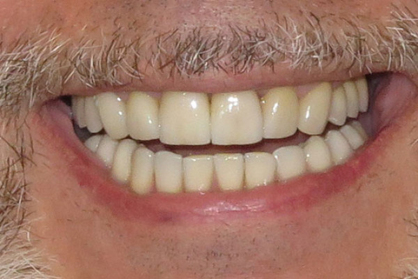 Cosmetic Dental Office 98604