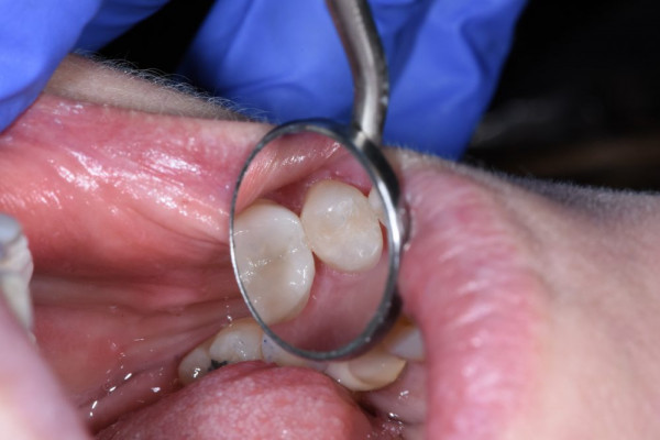 Cosmetic Dental Office 98604