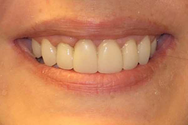 Dentist near Battle Ground