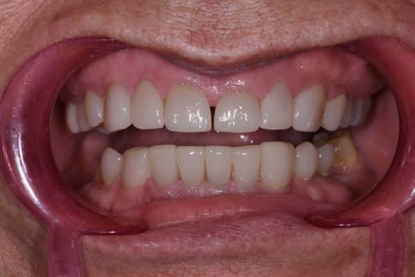 Dentist near Battle Ground