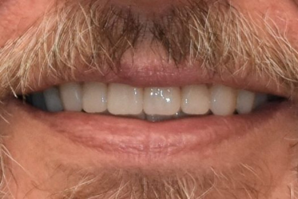 Dentist in Battle Ground