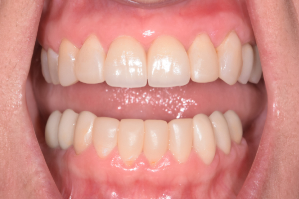 Dentist in Battle Ground