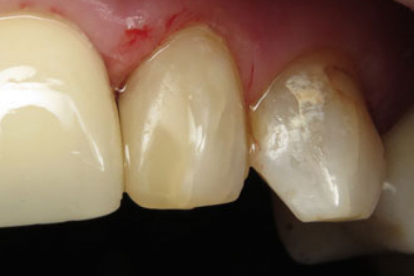 Dental Office in Battle Ground