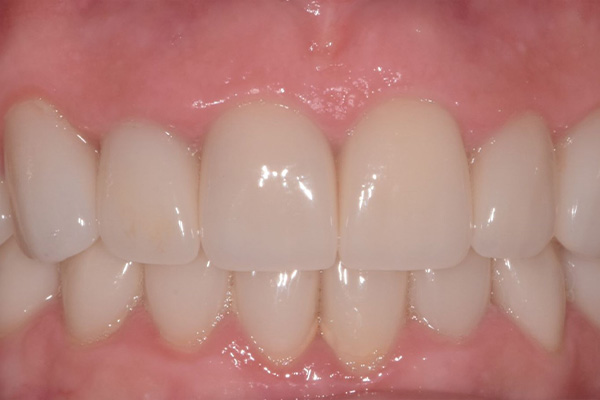 Above & Beyond Dentistry & Implants | Bone Grafting, TMJ & TMD and Technology