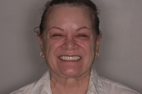 Above & Beyond Dentistry & Implants | Sedation Dentistry, Full Mouth Reconstruction and Root Canals