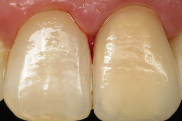 Dentist Battle Ground