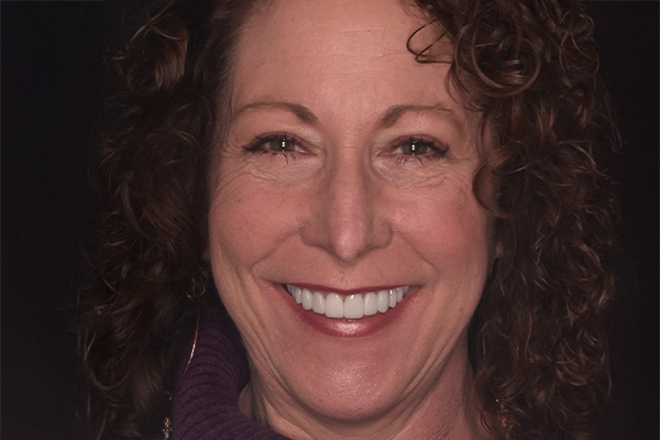 Above & Beyond Dentistry & Implants | All-on-X®, Sedation Dentistry and Chao Pinhole® Gum Rejuvenation