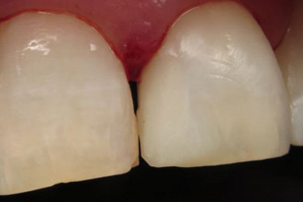 Cosmetic Dental Office 98604