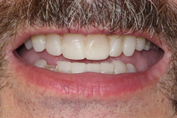 Dentist in Battle Ground