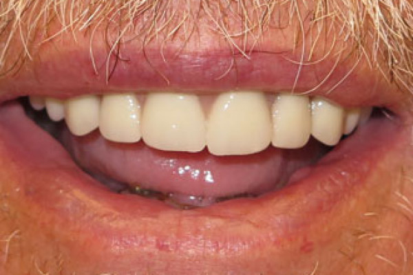 Dental Office in Battle Ground