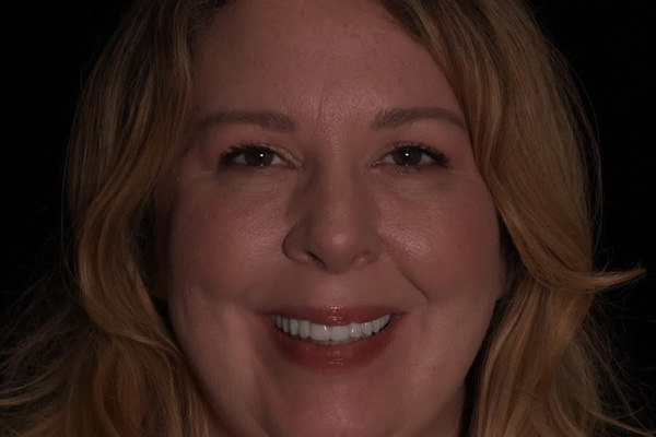 Above Beyond Dentistry Implants | Extractions, Wisdom Teeth Extractions and Bone Grafting