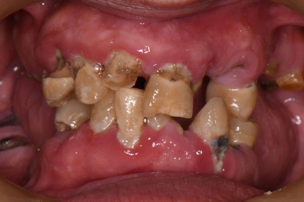 Above & Beyond Dentistry & Implants | Dental Implants, Veneers and Sedation Dentistry