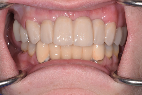 Dental Office in Battle Ground