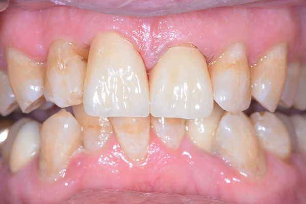 Dentist Battle Ground