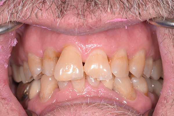 Dental Office in Battle Ground