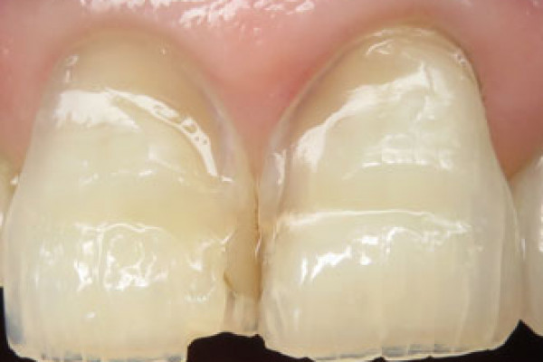 Dentist in Battle Ground