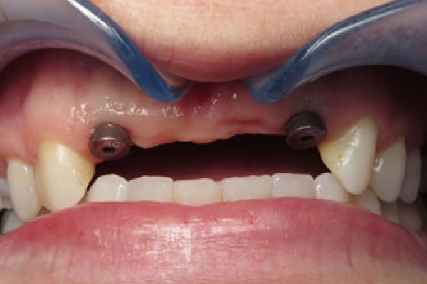 Cosmetic Dental Office Battle Ground