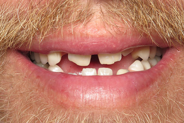 Dentist near Battle Ground