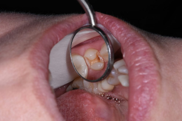 Cosmetic Dental Office 98604