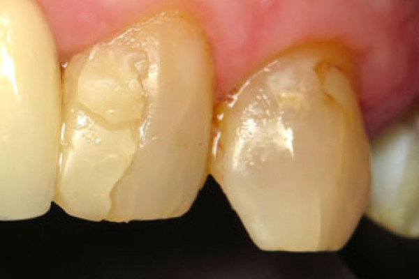 Dentist in Battle Grounds