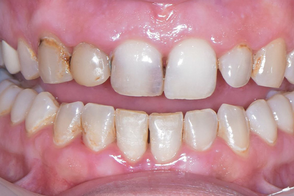 Above & Beyond Dentistry & Implants | Oral Hygiene, Sedation Dentistry and Full Mouth Reconstruction