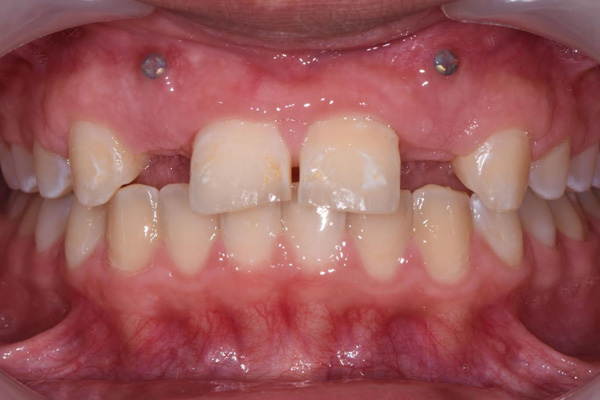 Above   Beyond Dentistry   Implants | Full Mouth Reconstruction, Teeth Whitening and Gum Disease