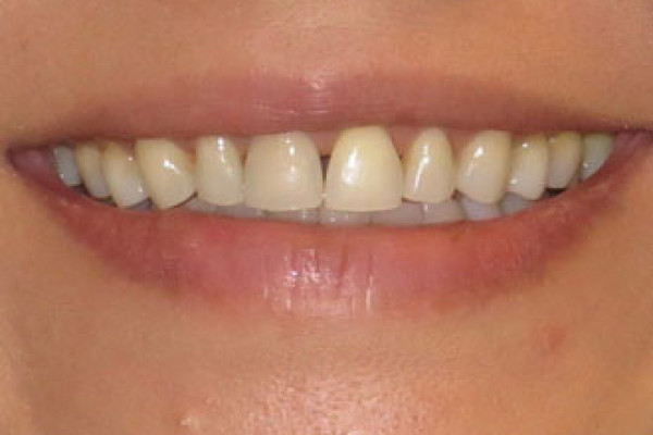 Family Dentist in Battle Ground