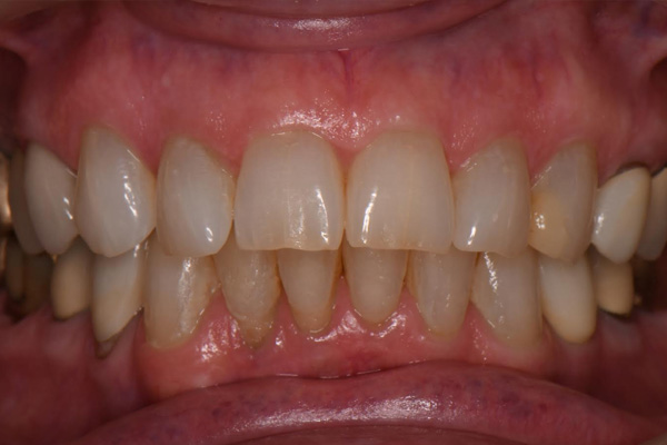 Above & Beyond Dentistry & Implants | TMJ & TMD, Root Canals and Dental Implants