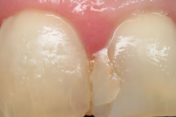 Dental Office in Battle Ground