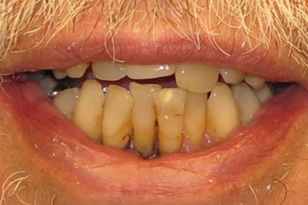 Battle Ground Cosmetic Dentist