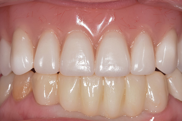 Battle Ground Cosmetic Dentist