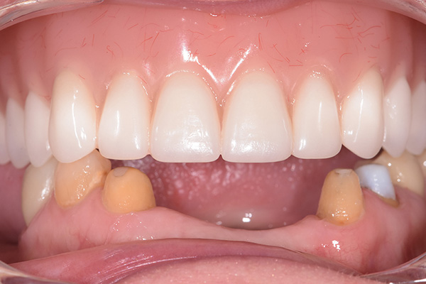 Family Dentist in Battle Ground