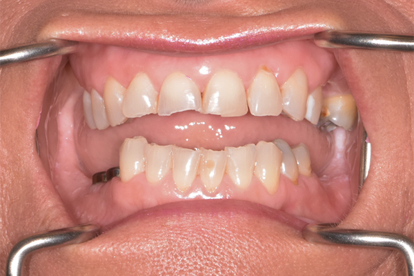 Dental Office in Battle Ground