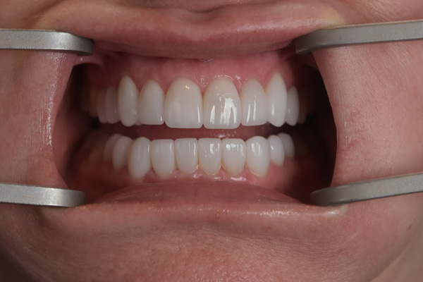 Above & Beyond Dentistry & Implants | Sedation Dentistry, Extractions and Full Mouth Reconstruction