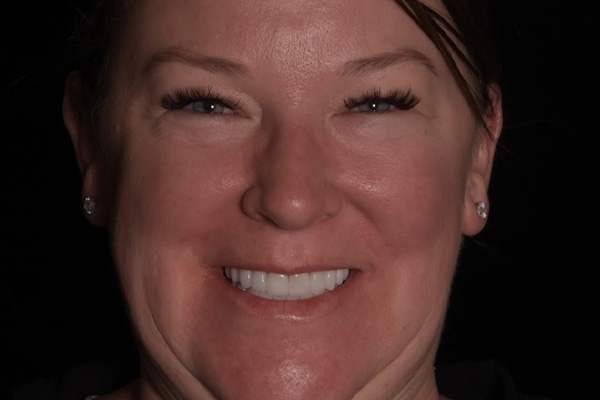 Above & Beyond Dentistry & Implants | TMJ & TMD, Wisdom Teeth Extractions and Teeth Whitening