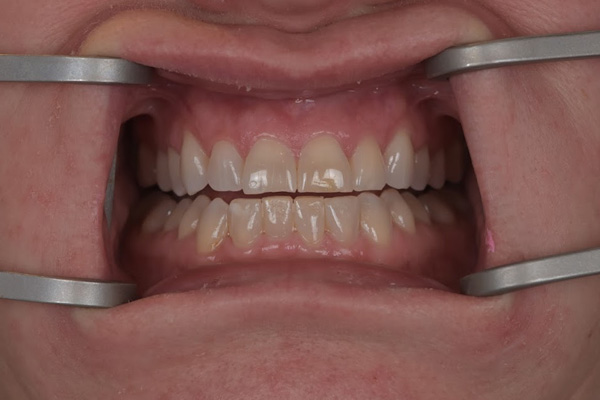 Above & Beyond Dentistry & Implants | Dentures, Bridges and Sedation Dentistry