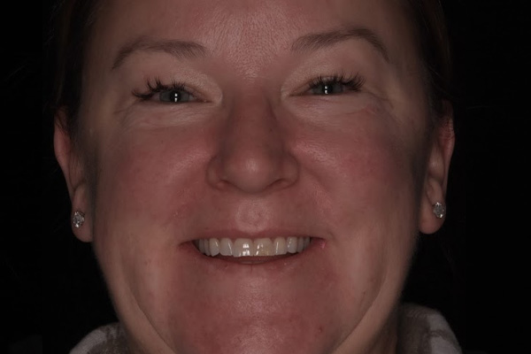 Above & Beyond Dentistry & Implants | Tooth Colored Fillings, Full Mouth Reconstruction and Sedation Dentistry