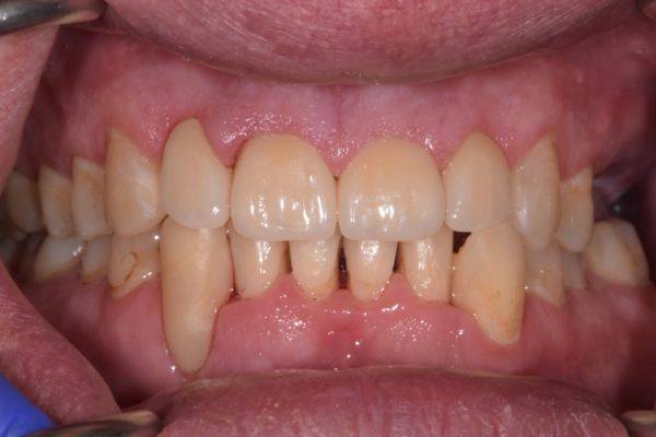 Dental Office in Battle Ground