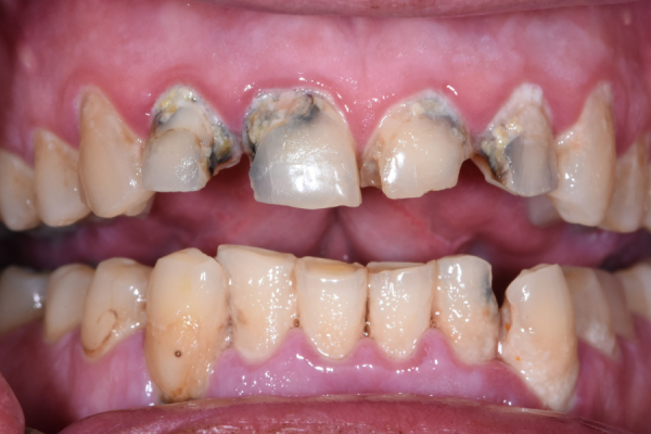 Family Dentist in Battle Ground