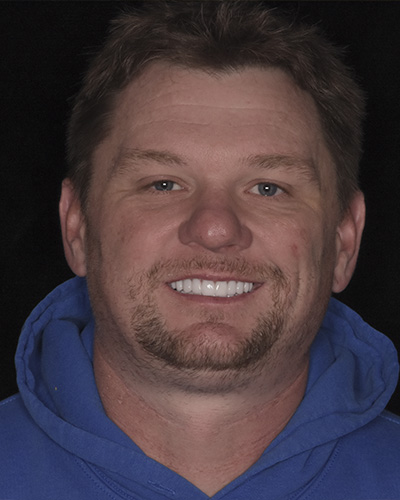 Above   Beyond Dentistry   Implants | Tooth Colored Fillings, Bridges and Teeth Whitening