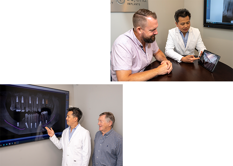 Above   Beyond Dentistry   Implants | Gum Disease, Root Canals and Bone Grafting